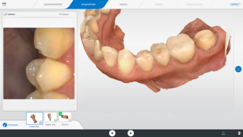 Cerec primescan 2