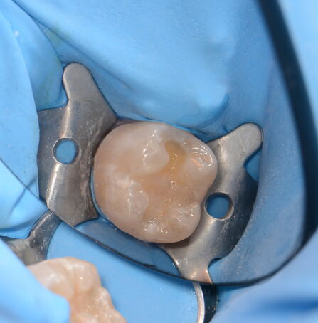 Vrstvení materiálu