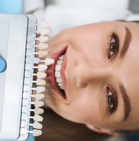 Keramické fasety - nový úsměv